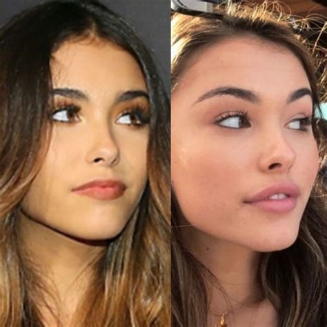 madison beer plastic sugery|Madison Beer Before And After Lip Fillers —Yay Or。